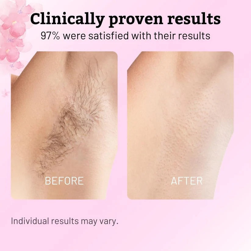 Cyperus Rotundus Hair Growth Inhibitor Oil – Gentle, Natural & Effective