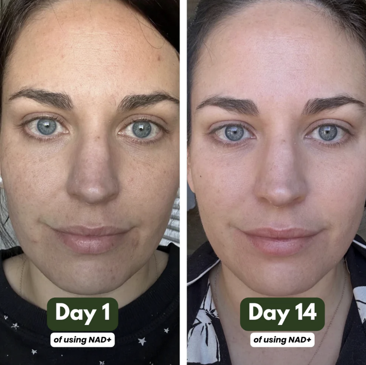 NAD+ Advanced - NAD Supplement for Skin, Energy & Focus