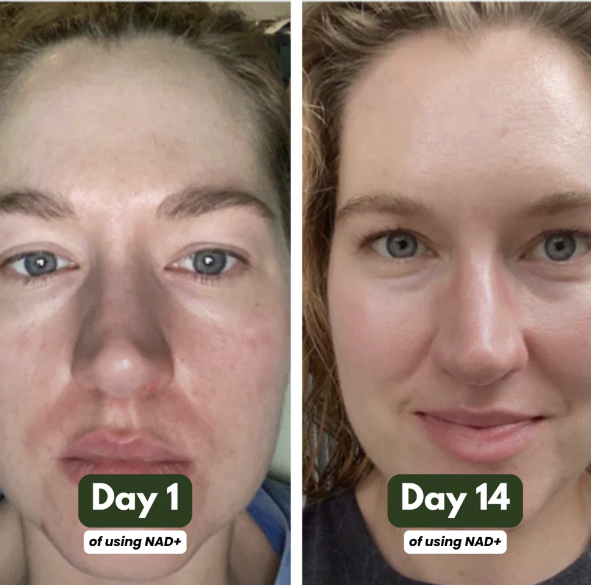 NAD+ Advanced - NAD Supplement for Skin, Energy & Focus