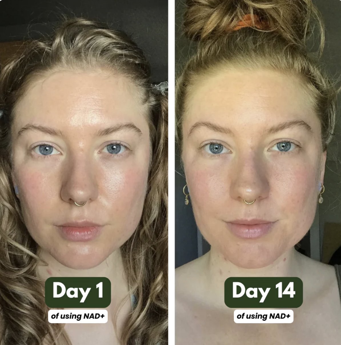 NAD+ Advanced - NAD Supplement for Skin, Energy & Focus